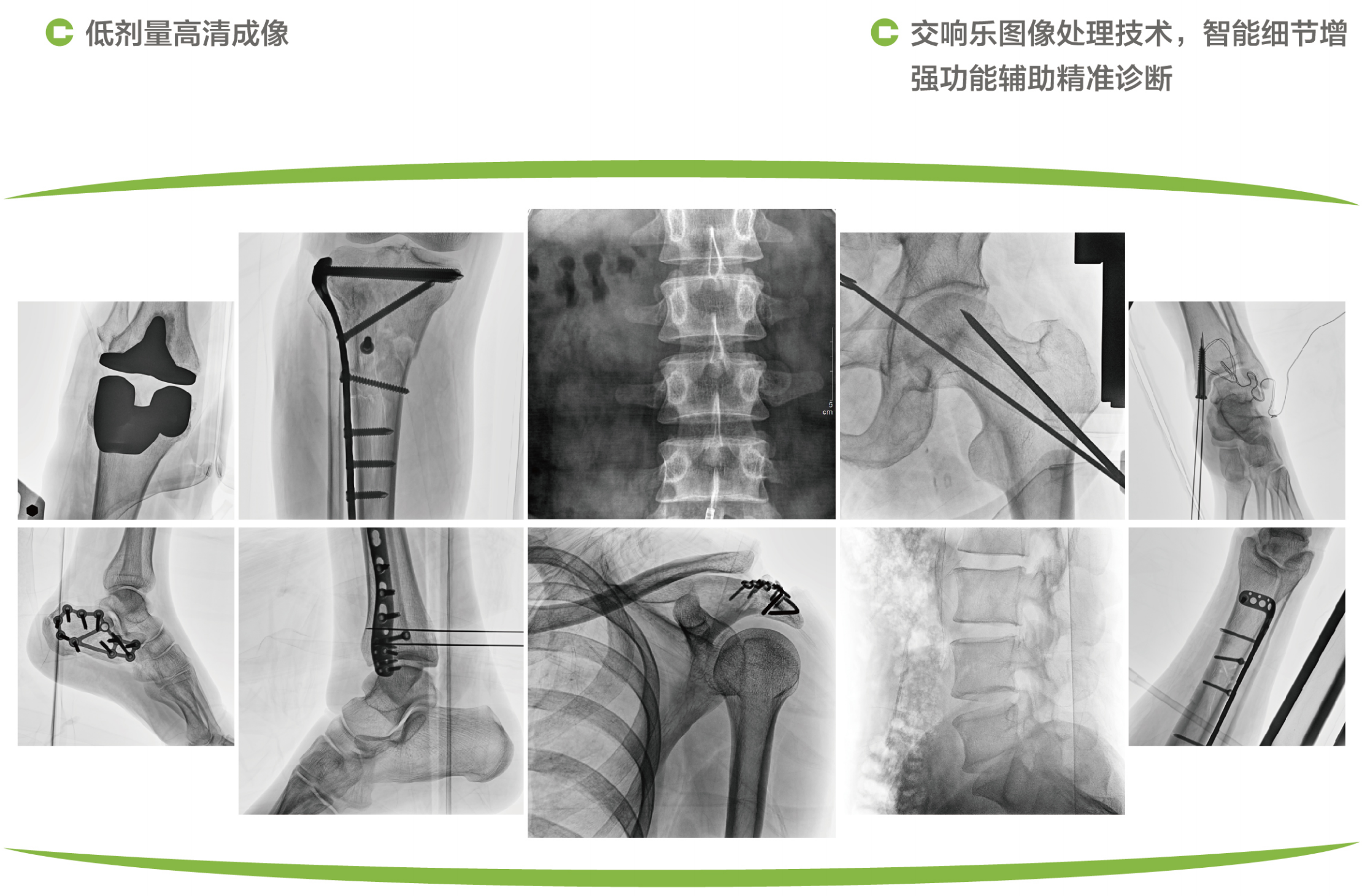 6移动式C形臂X射线机5.png